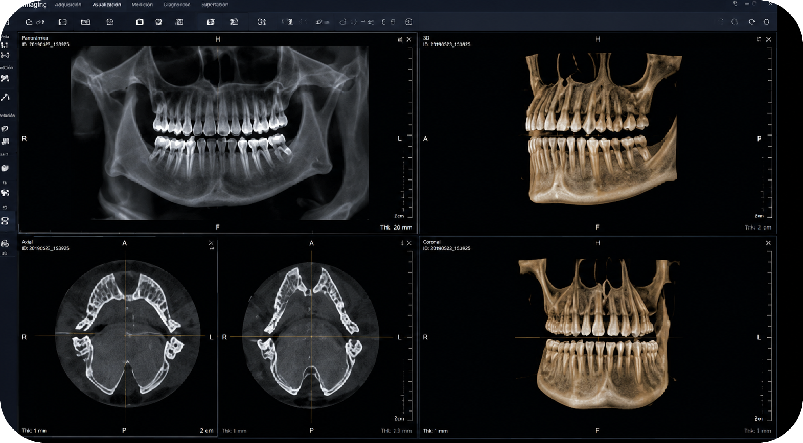 Software de imagenología digital odontológica