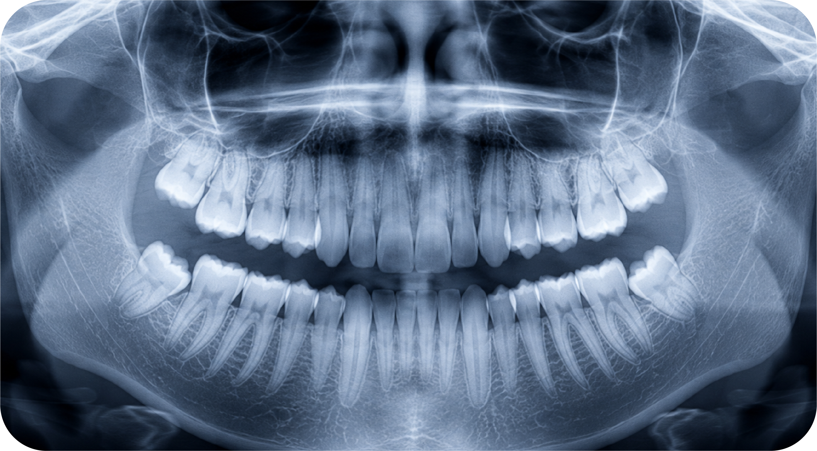 Radiografía panorámica odontológica